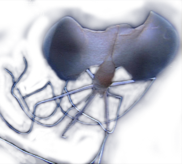 bigfin squid